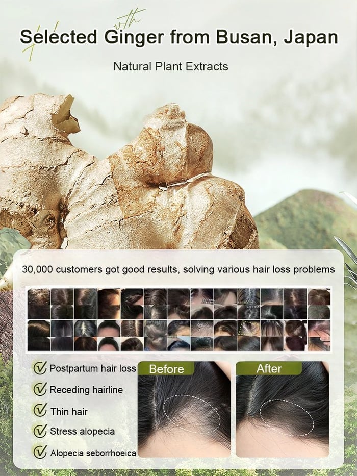 Ginger Plant Extract Anti-Hair Loss Hair Shampoo✨ BUY 1 GET 2 FREE- export