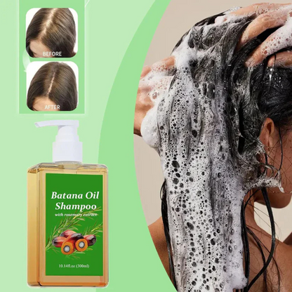 Batana Oil Shampoo for Male & Female (Buy 1 Get 1 Free)