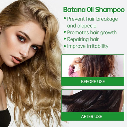 Batana Oil Shampoo for Male & Female (Buy 1 Get 1 Free)