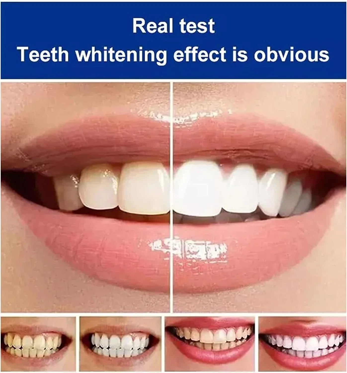 Ultra+ Teeth Whitening Toothpaste (BUY 1 GET 1 FREE)