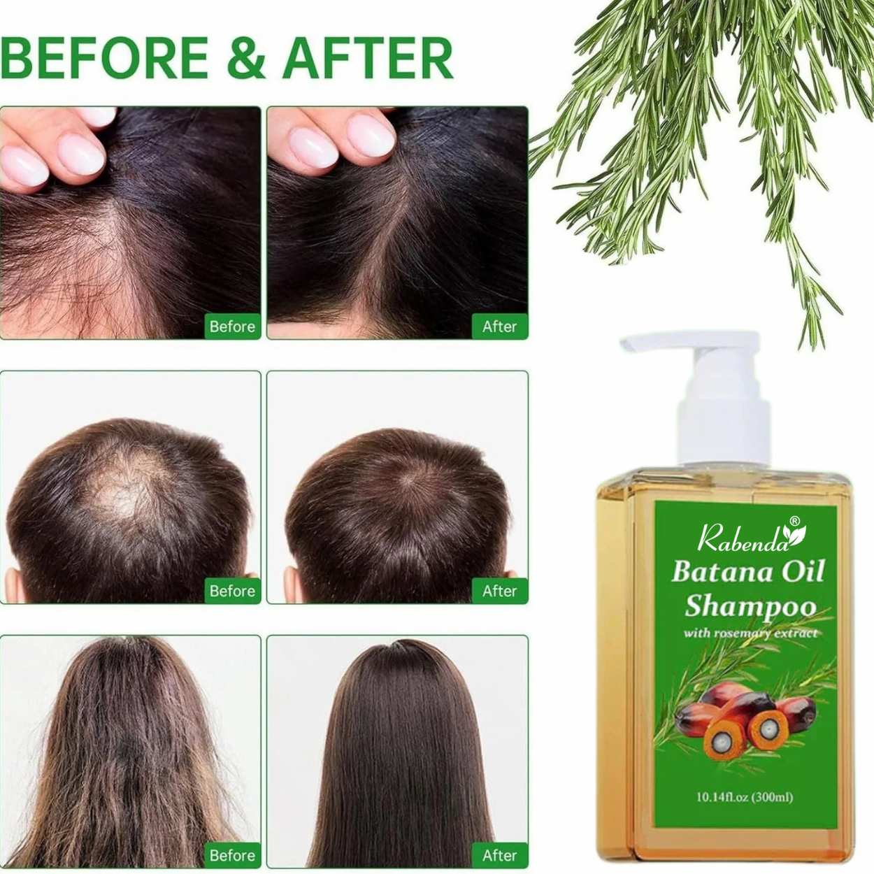 Batana Oil Shampoo for Male & Female (Buy 1 Get 1 Free)