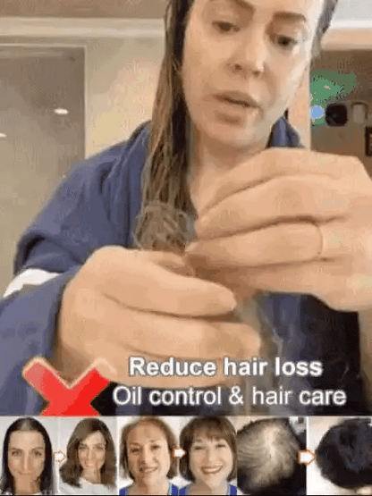 Anti-Hair Loss Hair Shampoo 200ml ( BUY 1 GET 2 FREE)