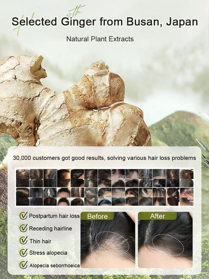 Ginger Plant Extract Anti-Hair Loss Hair Shampoo✨ BUY 1 GET 2 FREE- export