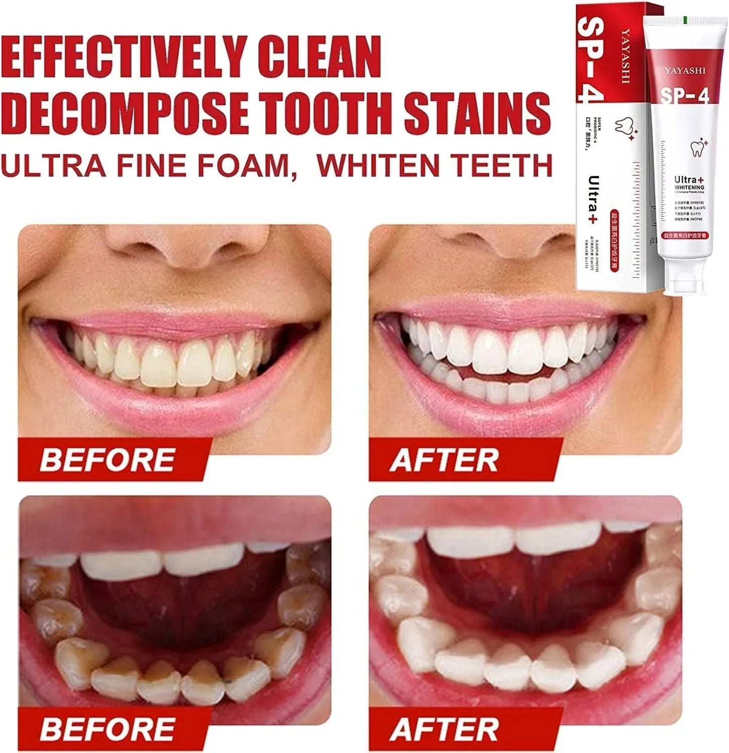 Ultra+ Teeth Whitening Toothpaste (BUY 1 GET 1 FREE)